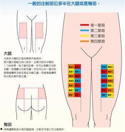 肌肉注射定位视频教程,精准注射，安全无忧